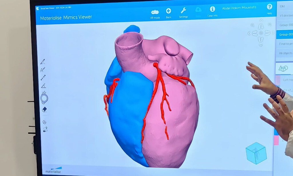 China necesita cardiólogos en una sociedad cada vez más envejecida. Su respuesta es una IA que «razona» como los mejores